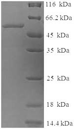 Recombinant Human Tyrosinase(TYR),partial