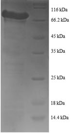 Recombinant Human Tyrosine--tRNA ligase, Cytoplasmic domain(YARS1)