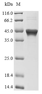 Recombinant Human Tyrosine-protein phosphatase non-receptor type 1(PTPN1),partial