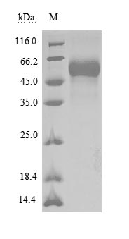 Recombinant Human Tyrosine-protein phosphatase non-receptor type substrate 1(SIRPA),partial (Active)