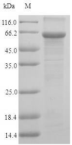 Recombinant Human UDP-N-acetylhexosamine pyrophosphorylase(UAP1)