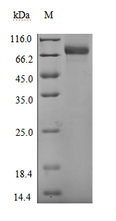 Recombinant Human UL16-binding protein 1(ULBP1),Biotinylated (Active)