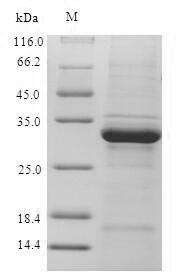 Recombinant Human Ubiquitin-conjugating enzyme E2 D3(UBE2D3)