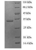 Recombinant Human Ubiquitin-conjugating enzyme E2 variant 2(UBE2V2)