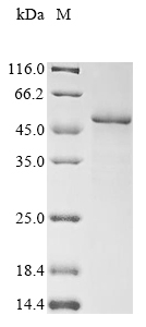 Recombinant Human Urokinase-type plasminogen activator(PLAU)