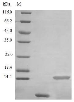 Recombinant Human Uteroglobin protein(SCGB1A1) (Active)