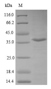 Recombinant Human Valacyclovir hydrolase(BPHL)