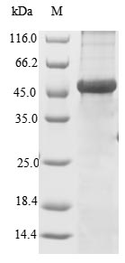 Recombinant Human Versican core protein(VCAN),partial
