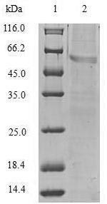 Recombinant Human Vimentin(VIM)