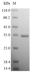 Recombinant Human Voltage-dependent calcium channel subunit alpha-2/delta-1(CACNA2D1),partial