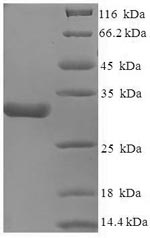 Recombinant Human Voltage-dependent calcium channel subunit alpha-2/delta-1(CACNA2D1),partial
