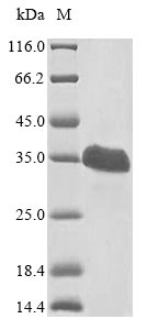 Recombinant Human Von Hippel-Lindau disease tumor suppressor(VHL)