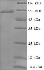 Recombinant Human Wilms tumor protein(WT1)