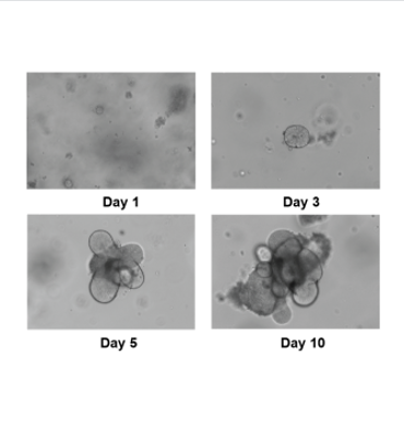 Recombinant Human Wnt3a protein(Active)