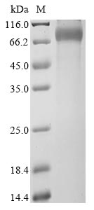 Recombinant Human X-linked retinitis pigmentosa GTPase regulator(RPGR),partial