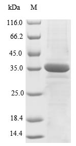 Recombinant Human X-ray repair cross-complementing protein 5(XRCC5),partial