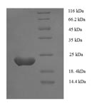 Recombinant Human Zinc finger protein GLI1(GLI1),partial