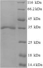 Recombinant Human cytomegalovirus Envelope glycoprotein H(gH),partial