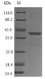 Recombinant Human fMet-Leu-Phe receptor(FPR1),partial