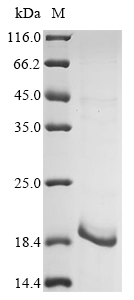 Recombinant Human immunodeficiency virus type 1 group M subtype K Protein Vpr(vpr)