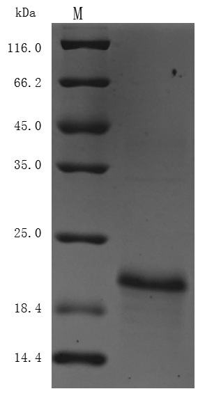 Recombinant Human papillomavirus type 16 Protein E7(E7) (Active)