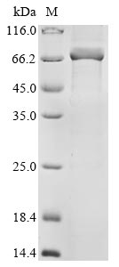 Recombinant Human parainfluenza 4b virus Nucleoprotein(N)