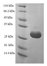 Recombinant Human tRNA methyltransferase 112 homolog(TRMT112)