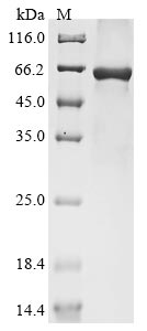 Recombinant Influenza A virus Hemagglutinin(HA),partial