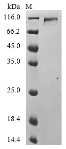 Recombinant Influenza A virus Hemagglutinin(HA),partial