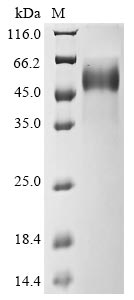 Recombinant Influenza A virus Hemagglutinin(HA),partial