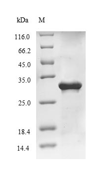 Recombinant Influenza A virus Matrix protein 1(M)