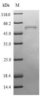 Recombinant Influenza A virus Nucleoprotein(NP)