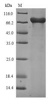 Recombinant Influenza A virus Nucleoprotein(NP)