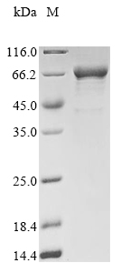 Recombinant Influenza B virus Nucleoprotein(NP)