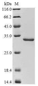 Recombinant Legionella longbeachae Outer membrane protein MIP(mip)
