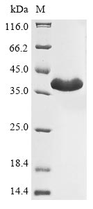 Recombinant Legionella pneumophila Zinc metalloproteinase