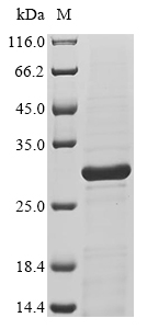 Recombinant Macaca fascicularis Interleukin-11(IL11)