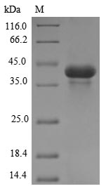 Recombinant Meleagris gallopavo Acrosin(ACR)