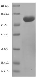 Recombinant Mouse 2-oxoglutaRate dehydrogenase, mitochondrial(Ogdh),partial
