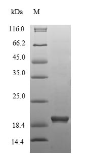 Recombinant Mouse 3-hydroxy-3-methylglutaryl-coenzyme A reductase (Hmgcr),partial
