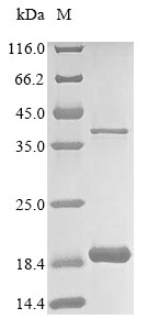 Recombinant Mouse Acyl-CoA desaturase 1(Scd1),partial