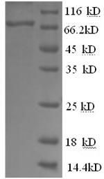 Recombinant Mouse Alpha-fetoprotein(Afp)