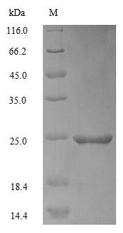 Recombinant Mouse Apolipoprotein C-III(Apoc3)