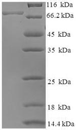Recombinant Mouse BAG family molecular chaperone regulator 3(Bag3)
