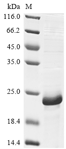Recombinant Mouse Baculoviral IAP repeat-containing protein 5(Birc5)