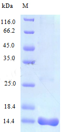 Recombinant Mouse C-C motif chemokine 25 protein(Ccl25) (Active)