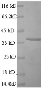 Recombinant Mouse CD63 antigen(Cd63),partial