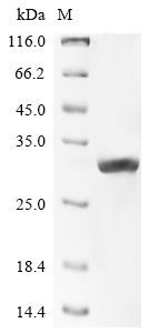Recombinant Mouse Carbamoyl-phosphate synthase [ammonia], mitochondrial(Cps1),partial
