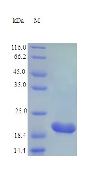 Recombinant Mouse Cardiotrophin-1 protein(Ctf1) (Active)