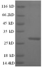 Recombinant Mouse Cathepsin K(Ctsk)